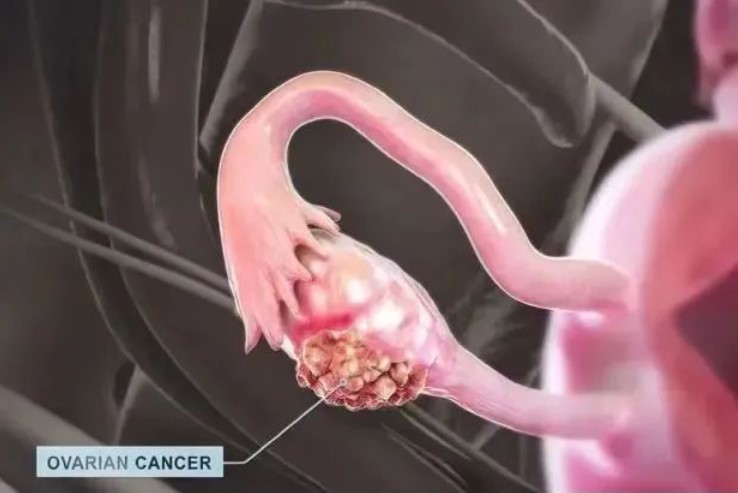 122121.jpg 122121.jpg